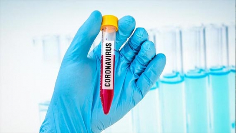 Ilmuwan Wuhan Bantah Keras Teori Virus Corona Bocor dari Lab