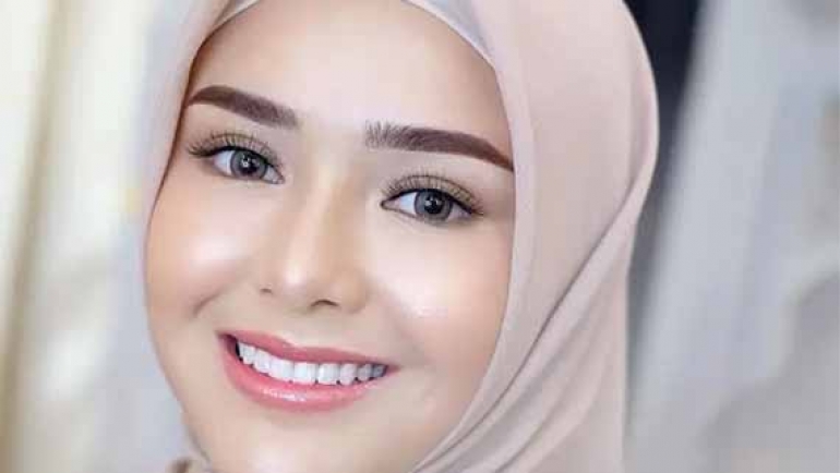 Dianggap Terkenal karena Billy Syahputra, Begini Respons Keluarga Amanda Manopo